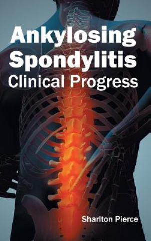 Kniha Ankylosing Spondylitis: Clinical Progress Sharlton Pierce