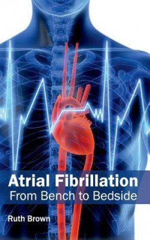 Knjiga Atrial Fibrillation: From Bench to Bedside Ruth Brown