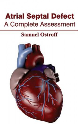 Book Atrial Septal Defect: A Complete Assessment Samuel Ostroff