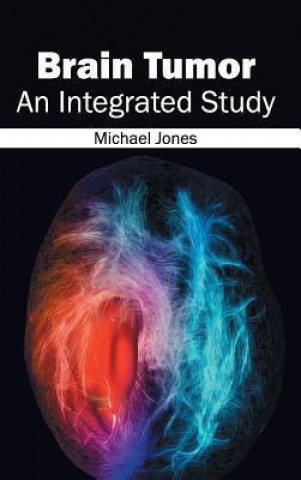 Kniha Brain Tumor: An Integrated Study Michael Jones