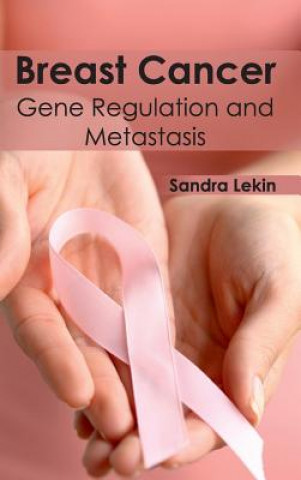 Knjiga Breast Cancer: Gene Regulation and Metastasis Sandra Lekin