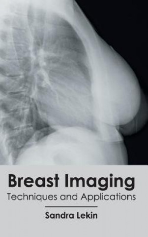 Könyv Breast Imaging: Techniques and Applications Sandra Lekin