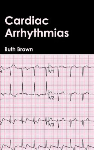 Kniha Cardiac Arrhythmias Ruth Brown