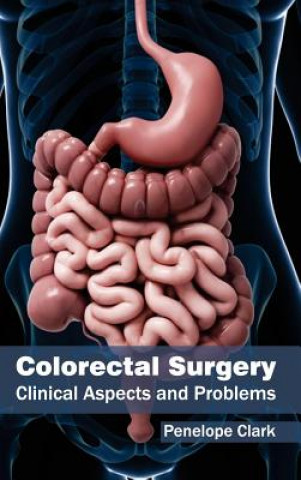 Kniha Colorectal Surgery: Clinical Aspects and Problems Penelope Clark