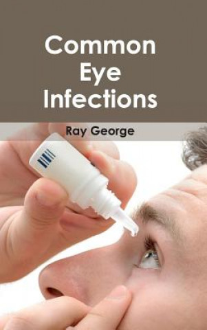 Boek Common Eye Infections Ray George