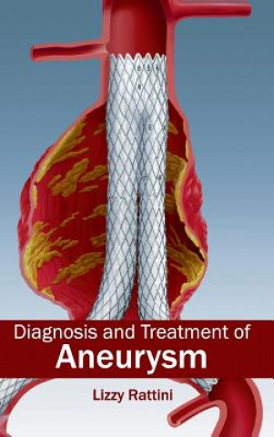 Libro Diagnosis and Treatment of Aneurysm Lizzy Rattini