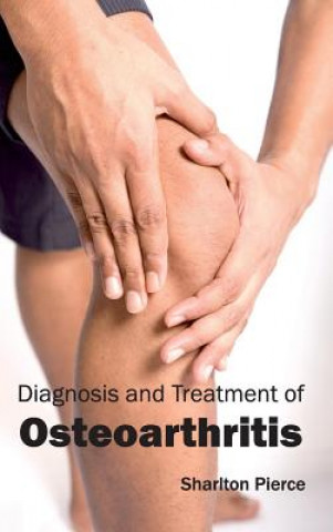 Kniha Diagnosis and Treatment of Osteoarthritis Sharlton Pierce