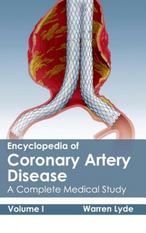 Könyv Encyclopedia of Coronary Artery Disease: Volume I (a Complete Medical Study) Warren Lyde