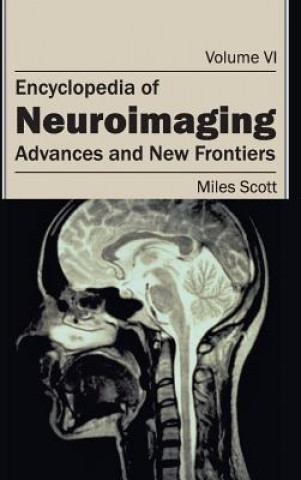 Kniha Encyclopedia of Neuroimaging: Volume VI (Advances and New Frontiers) Scott Miles