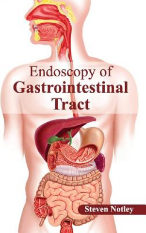 Kniha Endoscopy of Gastrointestinal Tract Steven Notley