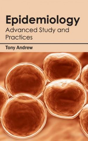 Knjiga Epidemiology: Advanced Study and Practices Tony Andrew