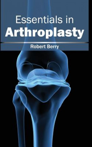 Boek Essentials in Arthroplasty Robert Berry