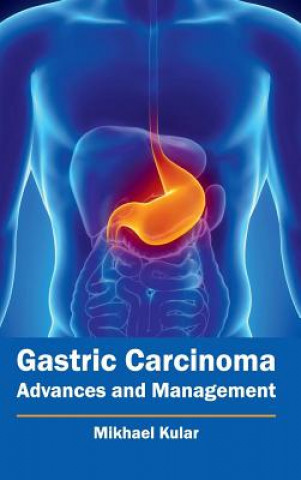 Книга Gastric Carcinoma: Advances and Management Mikhael Kular