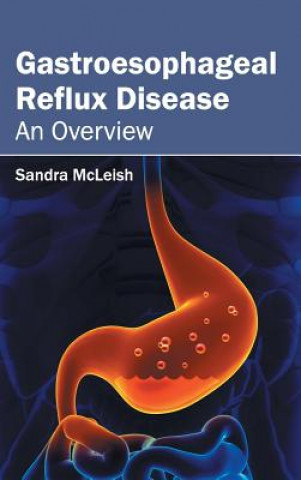 Könyv Gastroesophageal Reflux Disease: An Overview Sandra McLeish