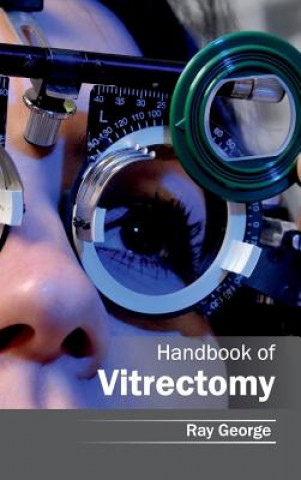 Kniha Handbook of Vitrectomy Ray George