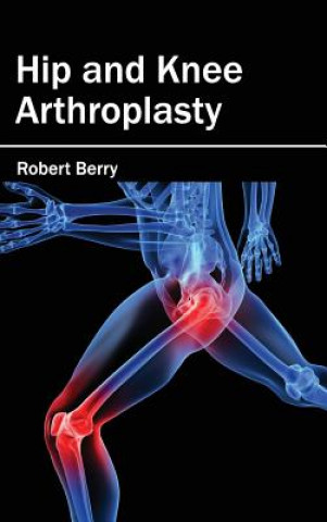 Könyv Hip and Knee Arthroplasty Robert Berry