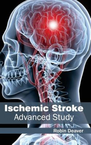Kniha Ischemic Stroke: Advanced Study Robin Deaver