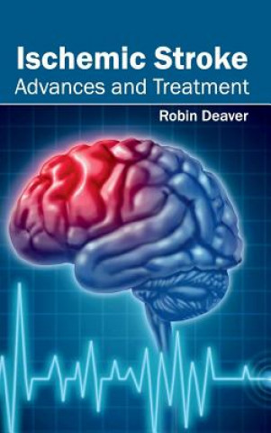Carte Ischemic Stroke: Advances and Treatment Robin Deaver