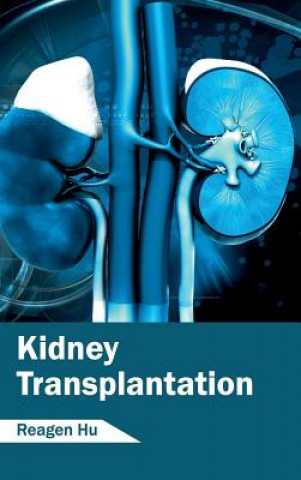 Книга Kidney Transplantation Reagen Hu