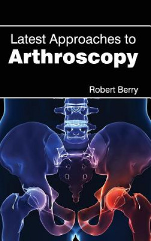 Kniha Latest Approaches to Arthroscopy Robert Berry