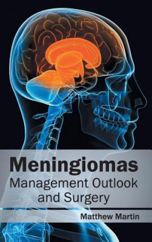 Kniha Meningiomas: Management Outlook and Surgery Matthew Martin