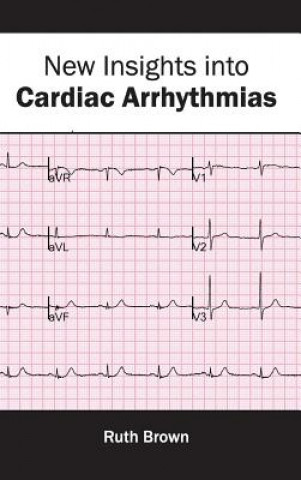Kniha New Insights Into Cardiac Arrhythmias Ruth Brown