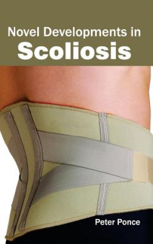 Kniha Novel Developments in Scoliosis Peter Ponce