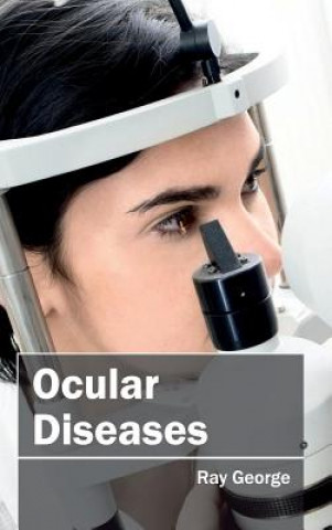 Könyv Ocular Diseases Ray George