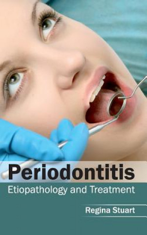 Carte Periodontitis: Etiopathology and Treatment Regina Stuart