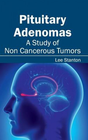 Kniha Pituitary Adenomas: A Study of Non Cancerous Tumors Lee Stanton