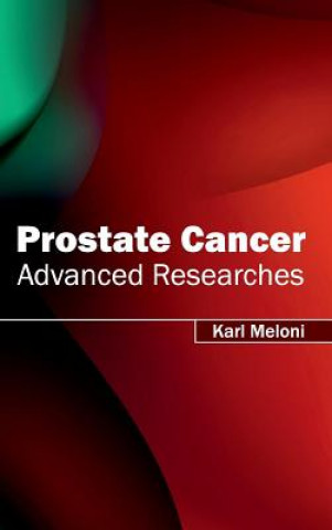 Knjiga Prostate Cancer: Advanced Researches Karl Meloni