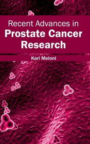 Carte Recent Advances in Prostate Cancer Research Karl Meloni