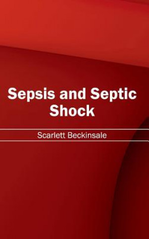 Kniha Sepsis and Septic Shock Scarlett Beckinsale