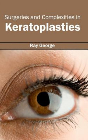 Книга Surgeries and Complexities in Keratoplasties Ray George