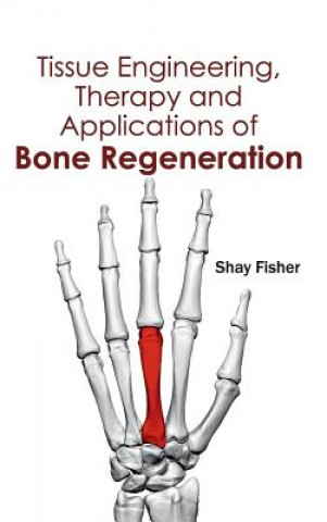 Knjiga Tissue Engineering, Therapy and Applications of Bone Regeneration Shay Fisher
