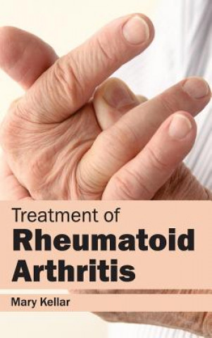 Kniha Treatment of Rheumatoid Arthritis Mary Kellar