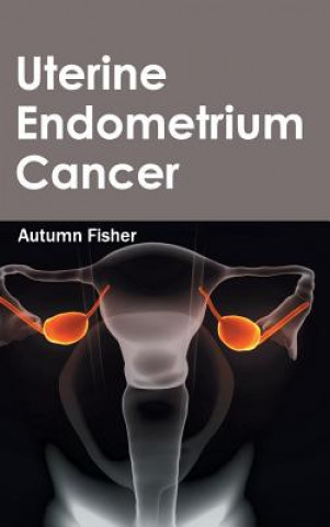 Könyv Uterine Endometrium Cancer Autumn Fisher