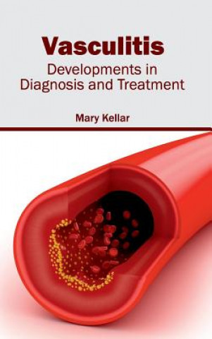 Carte Vasculitis: Developments in Diagnosis and Treatment Mary Kellar