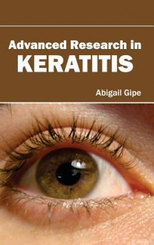 Knjiga Advanced Research in Keratitis Abigail Gipe