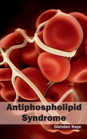 Könyv Antiphospholipid Syndrome Glenden Kaye