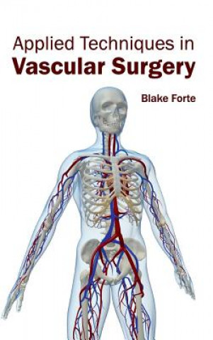 Książka Applied Techniques in Vascular Surgery Blake Forte