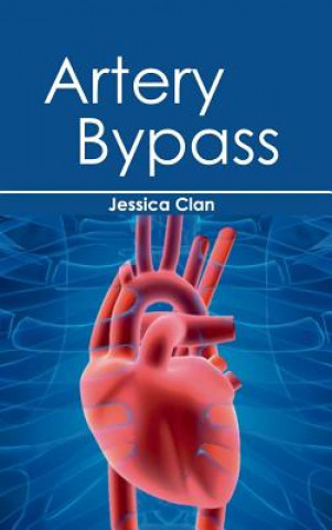 Книга Artery Bypass Jessica Clan