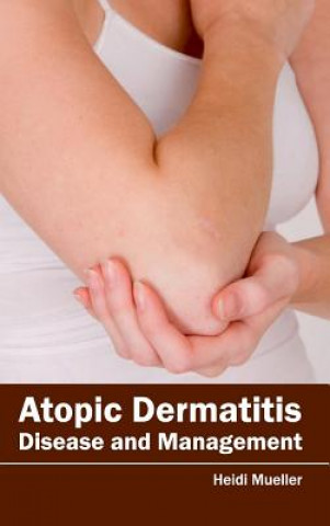 Kniha Atopic Dermatitis: Disease and Management Heidi Mueller