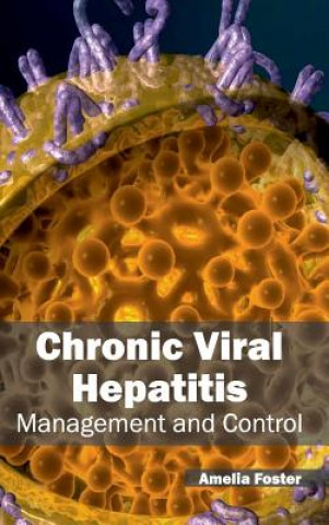 Kniha Chronic Viral Hepatitis: Management and Control Amelia Foster