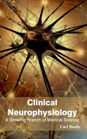 Carte Clinical Neurophysiology: A Growing Branch of Medical Science Carl Booth