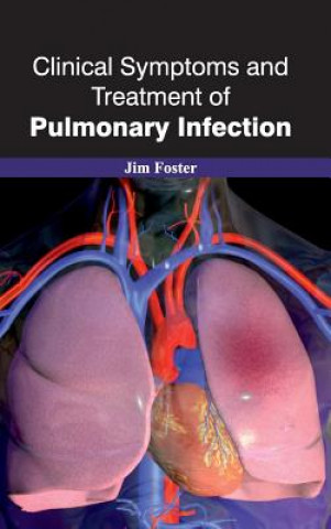 Kniha Clinical Symptoms and Treatment of Pulmonary Infection Jim Foster