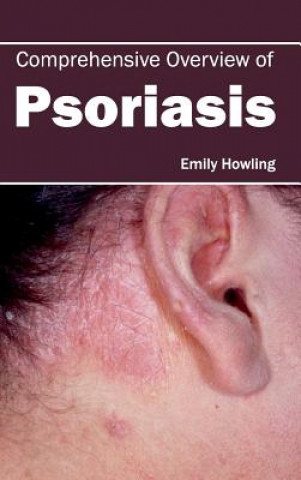 Kniha Comprehensive Overview of Psoriasis Emily Howling