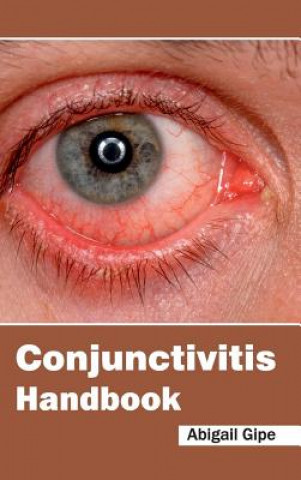 Carte Conjunctivitis Handbook Abigail Gipe