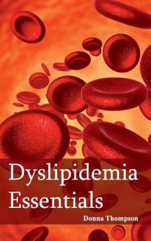 Kniha Dyslipidemia Essentials Donna Thompson