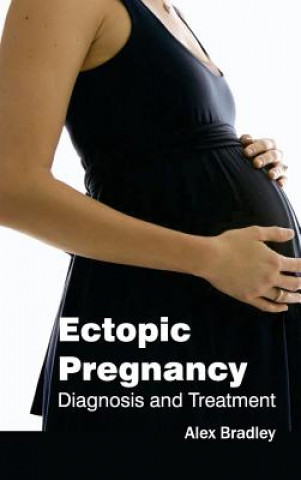 Książka Ectopic Pregnancy: Diagnosis and Treatment Alex Bradley